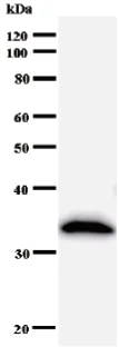 Western blot - Anti-ABCF2 antibody [2001C1] (AB50807)