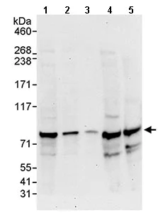 Western blot - Anti-ABCF3 antibody (AB113953)