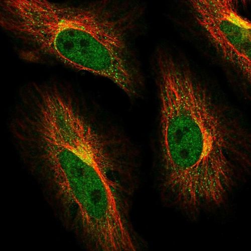 Immunocytochemistry/ Immunofluorescence - Anti-ABCG1 antibody (AB244442)