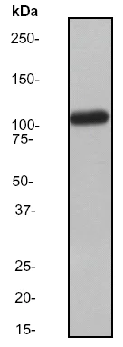 Western blot - Anti-ABCG1 antibody [EP1366Y] (AB52617)