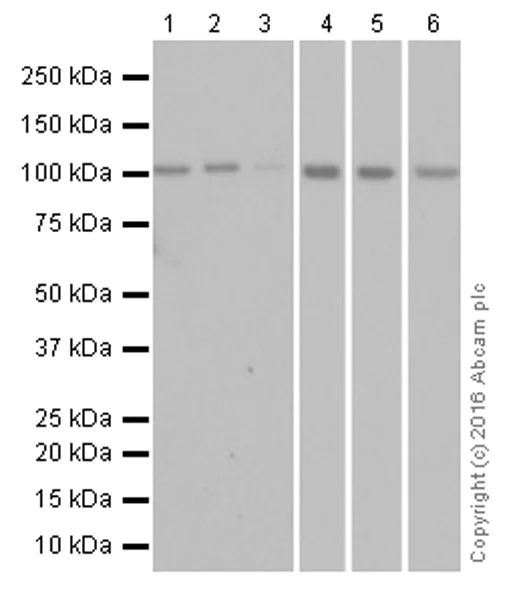 Western blot - Anti-ABCG1 antibody [EP1366Y] (AB52617)