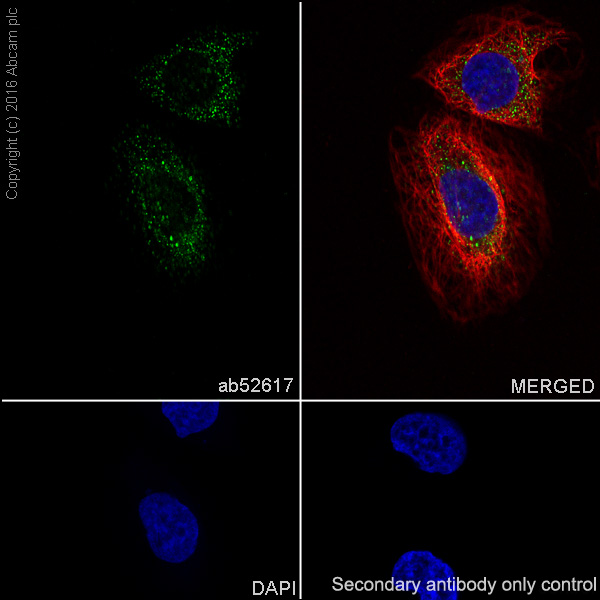 Immunocytochemistry/ Immunofluorescence - Anti-ABCG1 antibody [EP1366Y] - BSA and Azide free (AB218528)