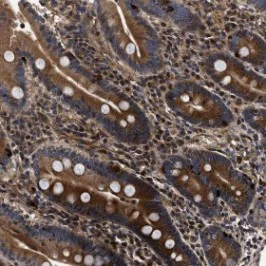 Immunohistochemistry (Formalin/PFA-fixed paraffin-embedded sections) - Anti-ABCG8 antibody (AB126493)