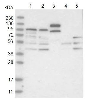 Western blot - Anti-ABCG8 antibody (AB126493)
