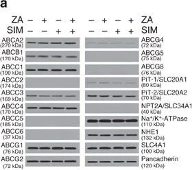 Western blot - Anti-ABCG8 antibody (AB126493)
