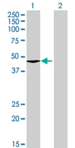 Western blot - Anti-ABHD12 antibody (AB68949)