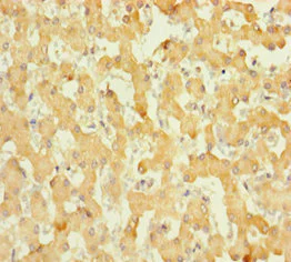 Immunohistochemistry (Formalin/PFA-fixed paraffin-embedded sections) - Anti-ABHD14B antibody (AB235436)