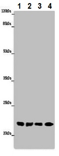 Western blot - Anti-ABHD14B antibody (AB235436), expandable thumbnail