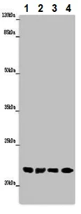 Western blot - Anti-ABHD14B antibody (AB235436)