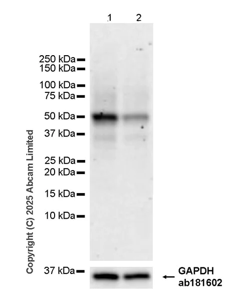 Western blot - Anti-ABHD2 antibody [EPR29769-536] (AB325139)