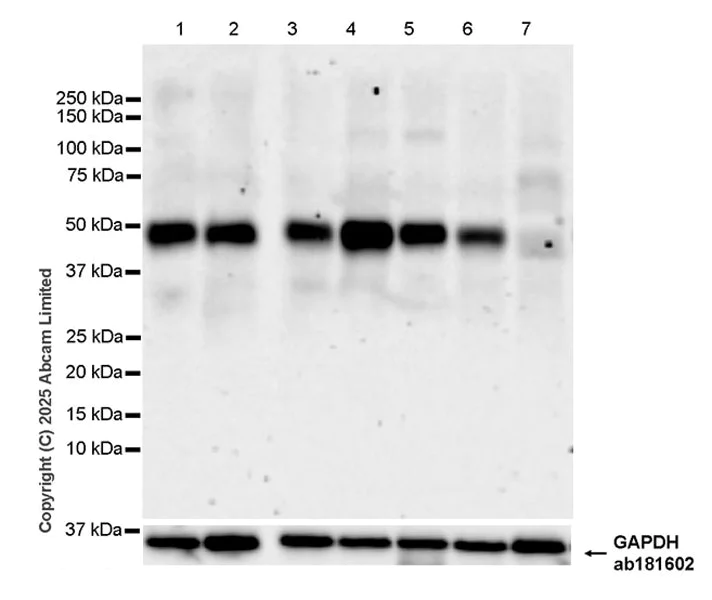 Western blot - Anti-ABHD2 antibody [EPR29769-536] (AB325139)