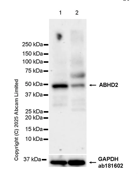 Western blot - Anti-ABHD2 antibody [EPR29769-536] (AB325139)