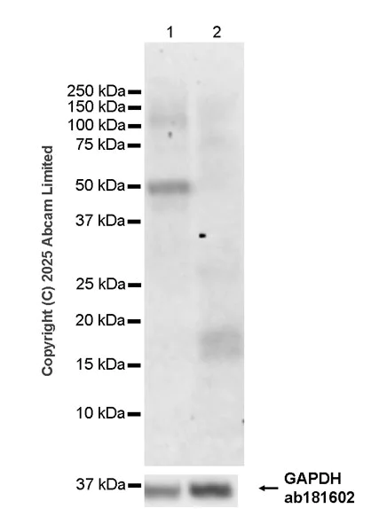 Western blot - Anti-ABHD2 antibody [EPR29769-536] (AB325139)