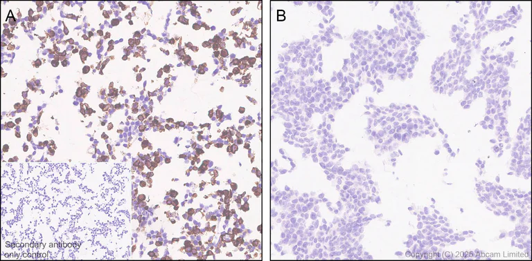 Immunohistochemistry (Formalin/PFA-fixed paraffin-embedded sections) - Anti-ABHD2 antibody [EPR29769-672] (AB324946)
