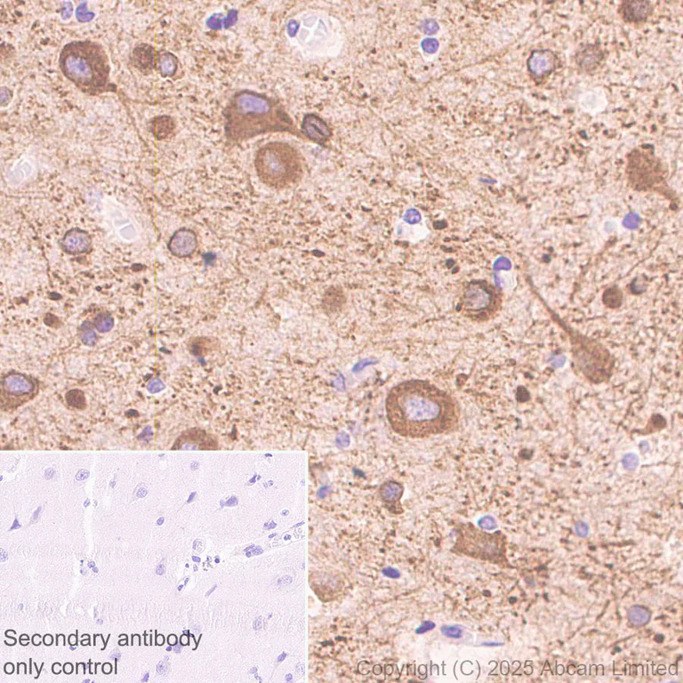 Immunohistochemistry (Formalin/PFA-fixed paraffin-embedded sections) - Anti-ABHD2 antibody [EPR29769-672] (AB324946)