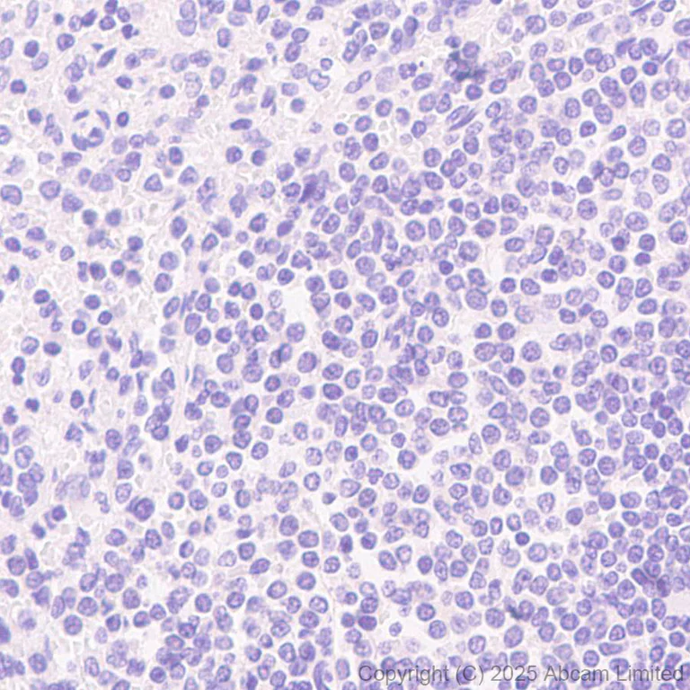 Immunohistochemistry (Formalin/PFA-fixed paraffin-embedded sections) - Anti-ABHD2 antibody [EPR29769-672] (AB324946)
