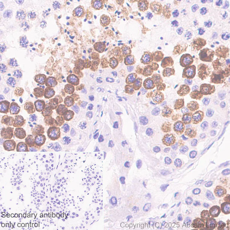 Immunohistochemistry (Formalin/PFA-fixed paraffin-embedded sections) - Anti-ABHD2 antibody [EPR29769-672] (AB324946)