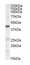 Western blot - Anti-Abhd5/CGI-58 antibody (AB111984)