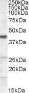 Western blot - Anti-Abhd5/CGI-58 antibody (AB59488)