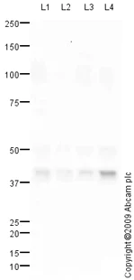 Western blot - Anti-Abhd5/CGI-58 antibody (AB73551)