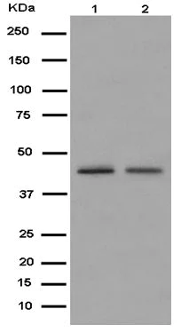 Western blot - Anti-Abhd5/CGI-58 antibody [EPR12621] (AB183739)