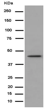 Western blot - Anti-Abhd5/CGI-58 antibody [EPR12621] (AB183739)