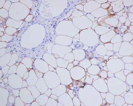 Immunohistochemistry (Formalin/PFA-fixed paraffin-embedded sections) - Anti-Abhd5/CGI-58 antibody [EPR12621] - BSA and Azide free (AB239001)