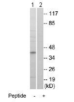 Western blot - Anti-ABHD6 antibody (AB74681)