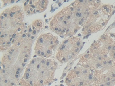Immunohistochemistry (Formalin/PFA-fixed paraffin-embedded sections) - Anti-Abi-1 antibody (AB233412)