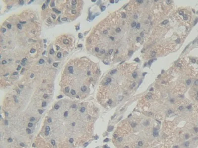 Immunohistochemistry (Formalin/PFA-fixed paraffin-embedded sections) - Anti-Abi-1 antibody (AB233412)