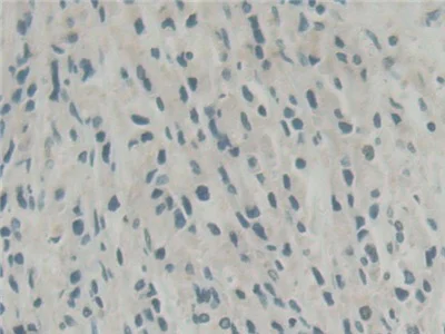 Immunohistochemistry (Formalin/PFA-fixed paraffin-embedded sections) - Anti-Abi-1 antibody (AB233412)