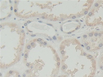 Immunohistochemistry (Formalin/PFA-fixed paraffin-embedded sections) - Anti-Abi-1 antibody (AB233412)