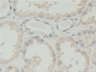 Immunohistochemistry (Formalin/PFA-fixed paraffin-embedded sections) - Anti-Abi-1 antibody (AB233412)