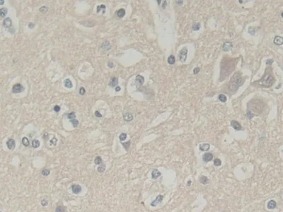 Immunohistochemistry (Formalin/PFA-fixed paraffin-embedded sections) - Anti-Abi-1 antibody (AB233412)