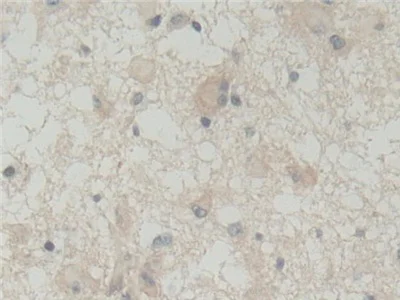 Immunohistochemistry (Formalin/PFA-fixed paraffin-embedded sections) - Anti-Abi-1 antibody (AB233412)