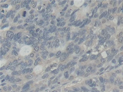 Immunohistochemistry (Formalin/PFA-fixed paraffin-embedded sections) - Anti-Abi-1 antibody (AB233412)