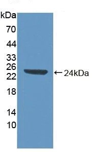 Western blot - Anti-Abi-1 antibody (AB233412)