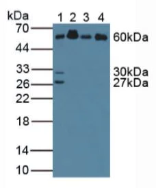 Western blot - Anti-Abi-1 antibody (AB233412)