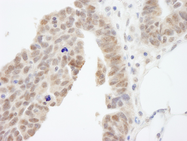 Immunohistochemistry (Formalin/PFA-fixed paraffin-embedded sections) - Anti-Abi-1 antibody (AB72318)