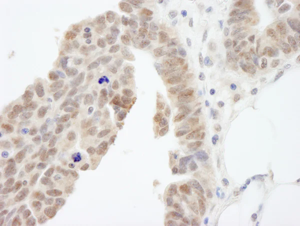 Immunohistochemistry (Formalin/PFA-fixed paraffin-embedded sections) - Anti-Abi-1 antibody (AB72318)
