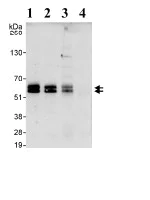 Immunoprecipitation - Anti-Abi-1 antibody (AB72318)