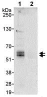 Immunoprecipitation - Anti-Abi-1 antibody (AB72318)