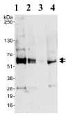 Western blot - Anti-Abi-1 antibody (AB72318)