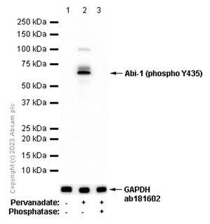 Western blot - Anti-Abi-1 (phospho Y435) antibody [EP3954] (AB109395)
