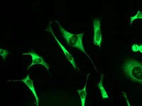 Immunocytochemistry/ Immunofluorescence - Anti-ABI2 antibody [EPR3906] (AB108340)