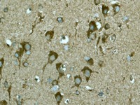 Immunohistochemistry (Formalin/PFA-fixed paraffin-embedded sections) - Anti-ABI2 antibody [EPR3906] (AB108340)