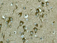Immunohistochemistry (Formalin/PFA-fixed paraffin-embedded sections) - Anti-ABI2 antibody [EPR3906] (AB108340)