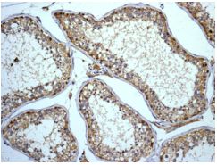 Immunohistochemistry (Formalin/PFA-fixed paraffin-embedded sections) - Anti-ABI2 antibody [EPR7069] (AB133593)
