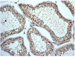Immunohistochemistry (Formalin/PFA-fixed paraffin-embedded sections) - Anti-ABI2 antibody [EPR7069] (AB133593)