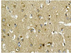 Immunohistochemistry (Formalin/PFA-fixed paraffin-embedded sections) - Anti-ABI2 antibody [EPR7069] (AB133593)